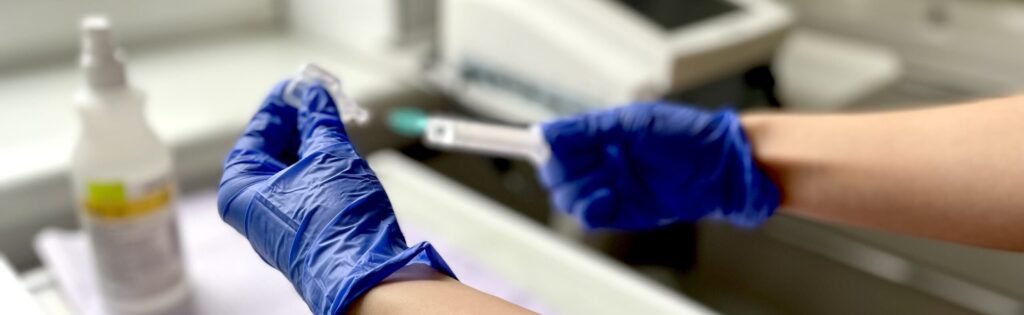 Pracownik medyczny w rękawiczkach przygotowujący próbkę do badania laboratoryjnego.